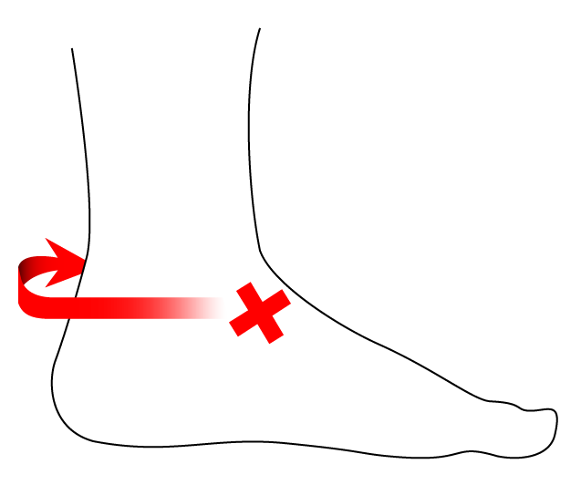 Profile view of a foot’s right side with a red ‘X’ on the instep